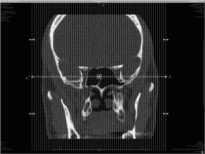 The cat scan slices of my head - sagittal sections